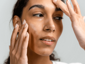 How to Use Vitamin C for Dark Spots, According to Dermatologists