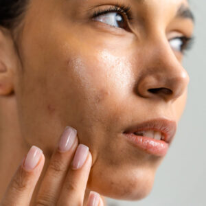 If You Have Oily Skin, Should You Moisturize at Night?